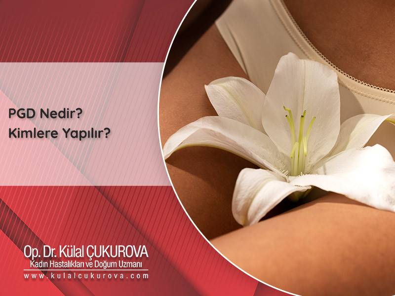 op-dr-kulal-cukurova-pgd-nedir-kimlere-yapilir